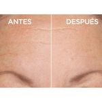 Antes-y-despues-de-usar-serum-facial-en-el-rostro