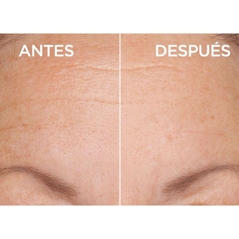 Antes-y-despues-de-usar-serum-facial-en-el-rostro